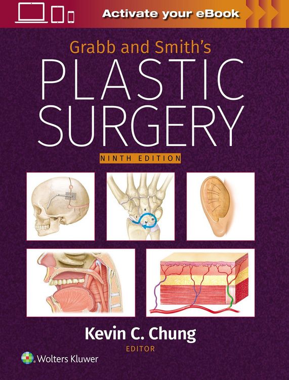 Produktbild: Grabb and Smith's Plastic Surgery: Print + eBook with Multimedia