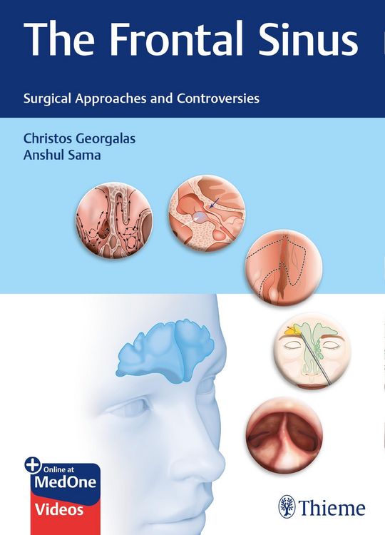 Produktbild: The Frontal Sinus