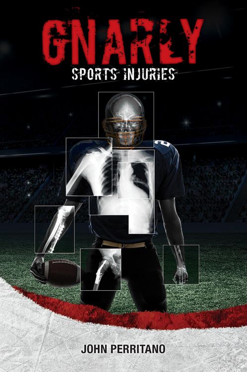 Produktbild: Gnarly Sports Injuries