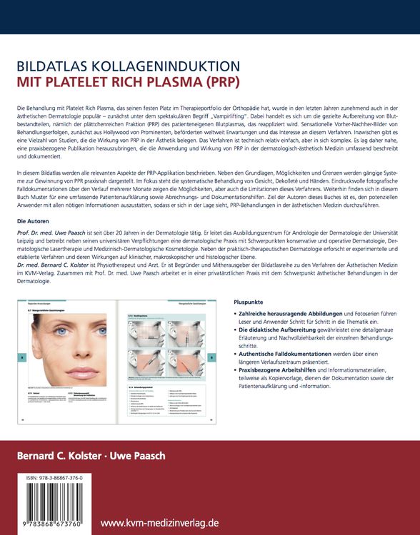 Produktbild: Bildatlas Kollageninduktion mit Platelet Rich Plasma (PRP)