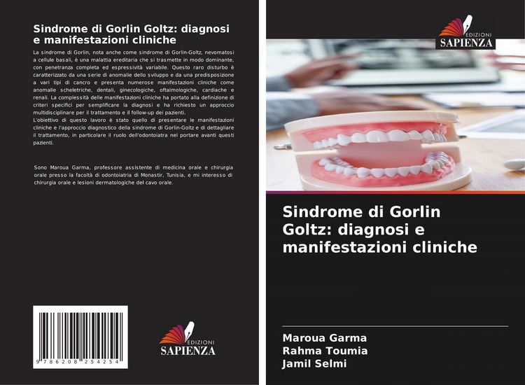 Produktbild: Sindrome di Gorlin Goltz: diagnosi e manifestazioni cliniche