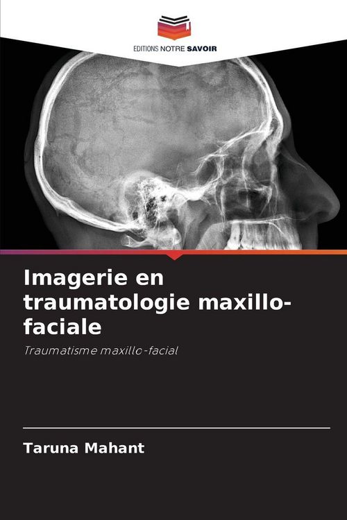 Produktbild: Imagerie en traumatologie maxillo-faciale