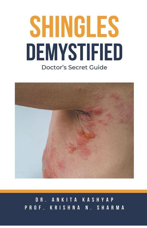 Produktbild: Shingles Demystified