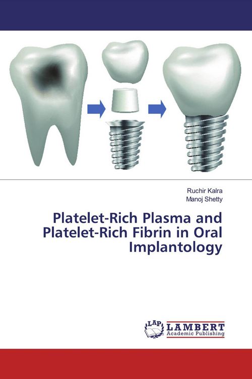 Produktbild: Platelet-Rich Plasma and Platelet-Rich Fibrin in Oral Implantology
