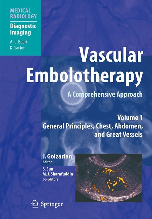 Produktbild: Vascular Embolotherapy