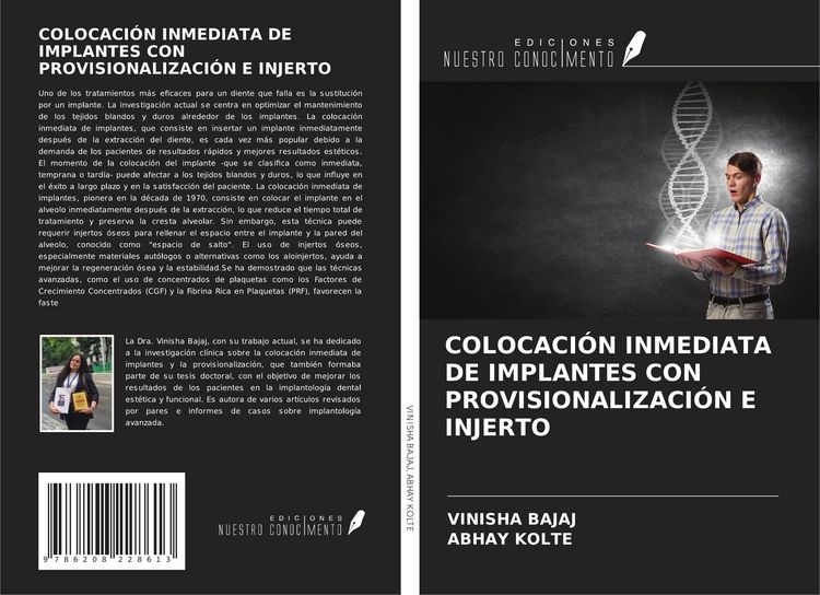 Produktbild: Colocaci&oacute;n Inmediata De Implantes Con Provisionalizaci&oacute;n E Injerto