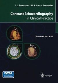 Produktbild: Contrast Echocardiography in Clinical Practice