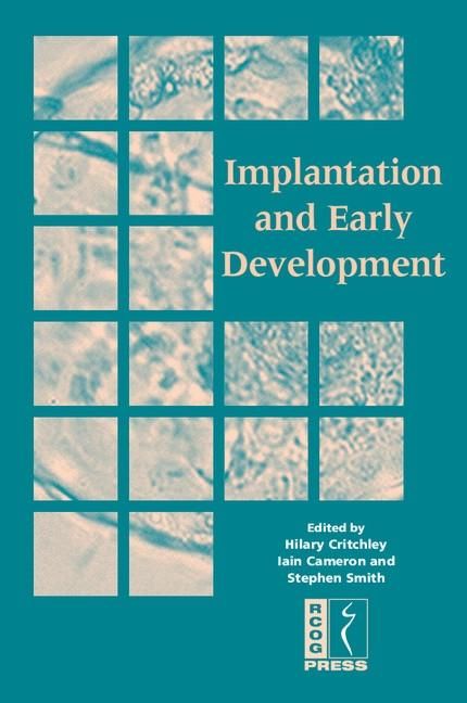 Produktbild: Implantation and Early Development