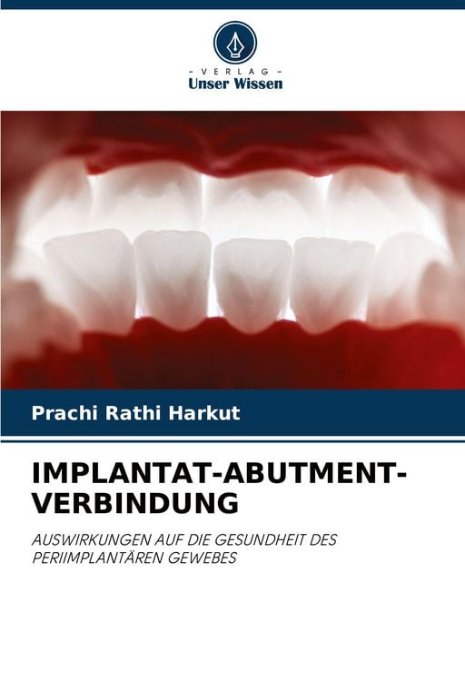Produktbild: Implantat-Abutment-Verbindung