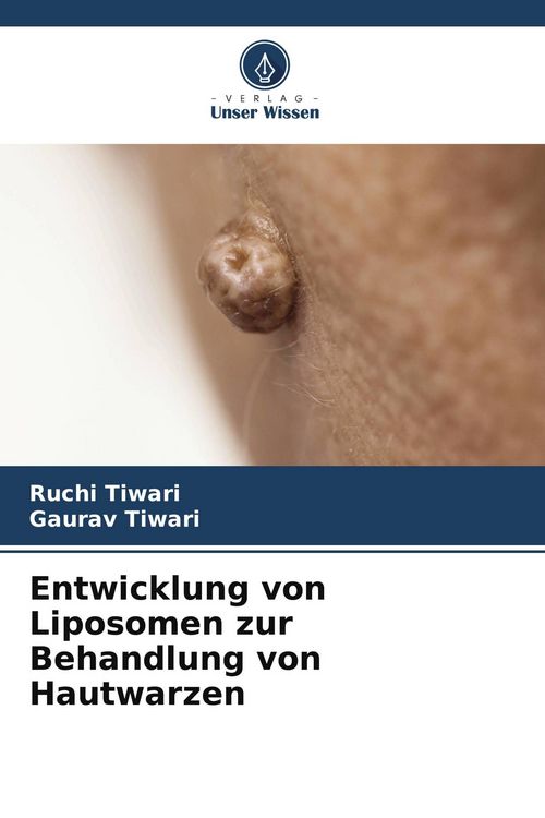 Produktbild: Entwicklung von Liposomen zur Behandlung von Hautwarzen