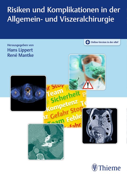 Produktbild: Risiken und Komplikationen in der Allgemein- und Viszeralchirurgie