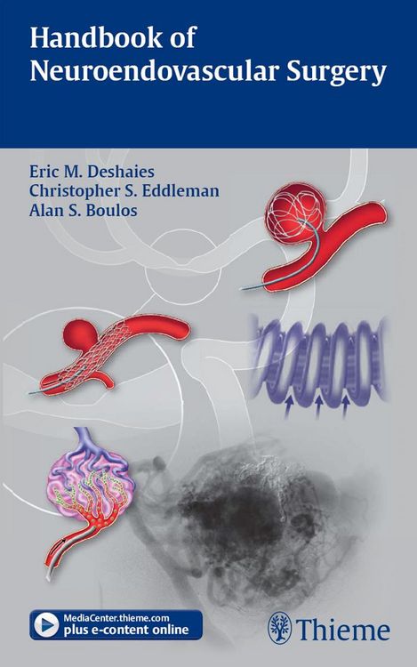 Produktbild: Handbook of Neuroendovascular Surgery