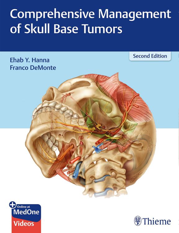 Produktbild: Comprehensive Management of Skull Base Tumors