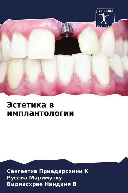 Produktbild: Jestetika w implantologii