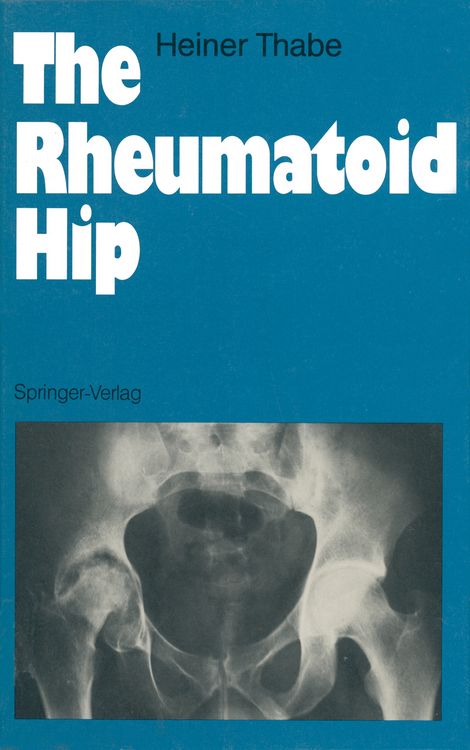 Produktbild: The Rheumatoid Hip