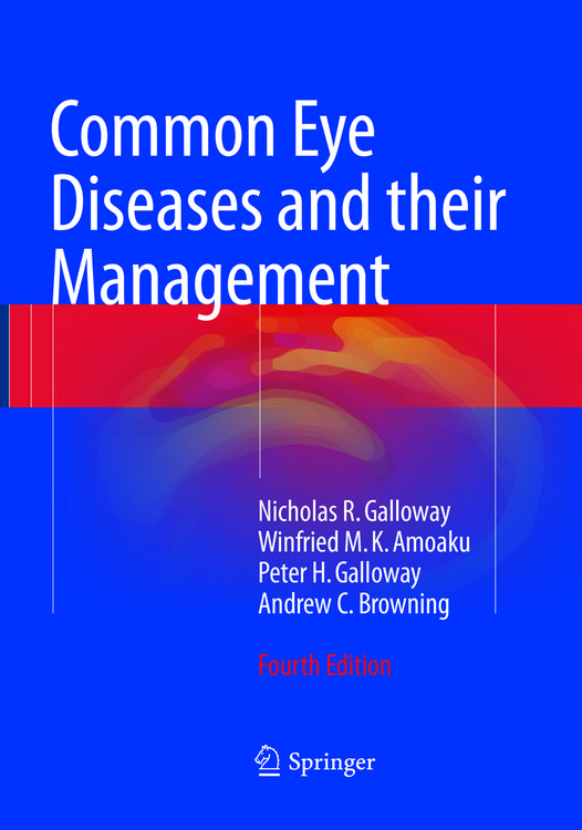 Produktbild: Common Eye Diseases and their Management