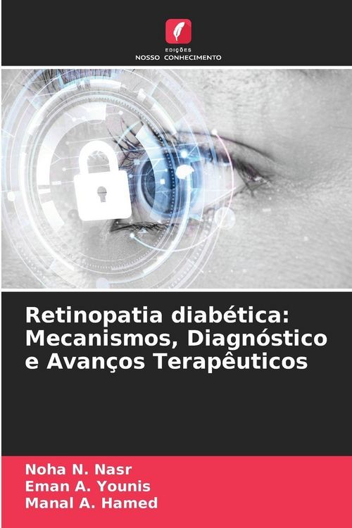 Produktbild: Retinopatia diab&eacute;tica: Mecanismos, Diagn&oacute;stico e Avan&ccedil;os Terap&ecirc;uticos