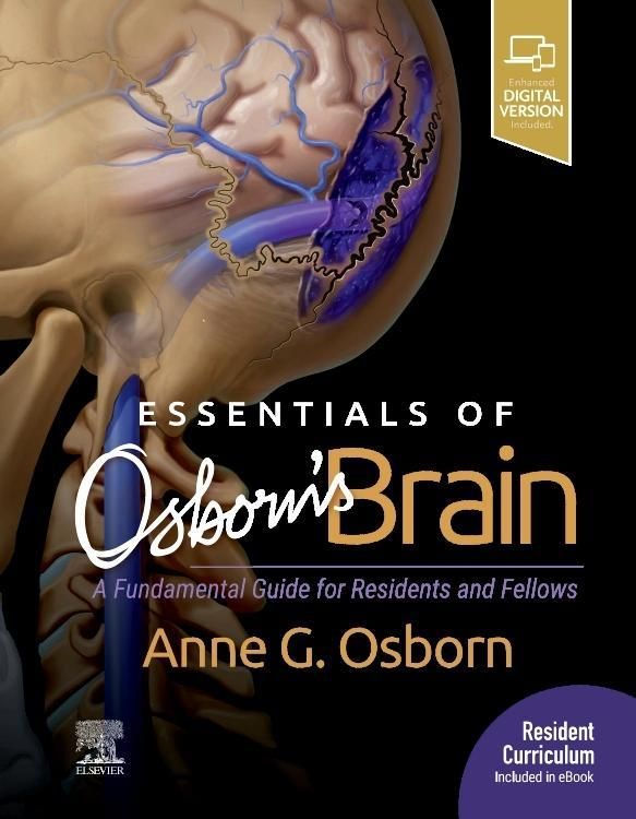 Produktbild: Essentials of Osborn's Brain