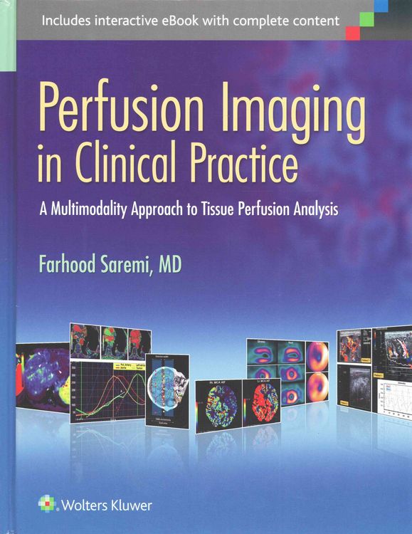 Produktbild: Perfusion Imaging in Clinical