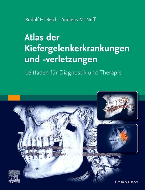 Produktbild: Atlas der Kiefergelenkerkrankungen und -verletzungen