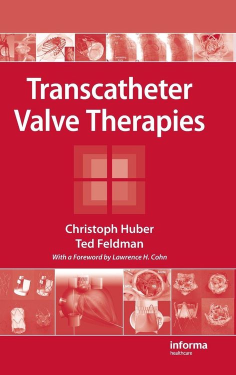 Produktbild: Transcatheter Valve Therapies