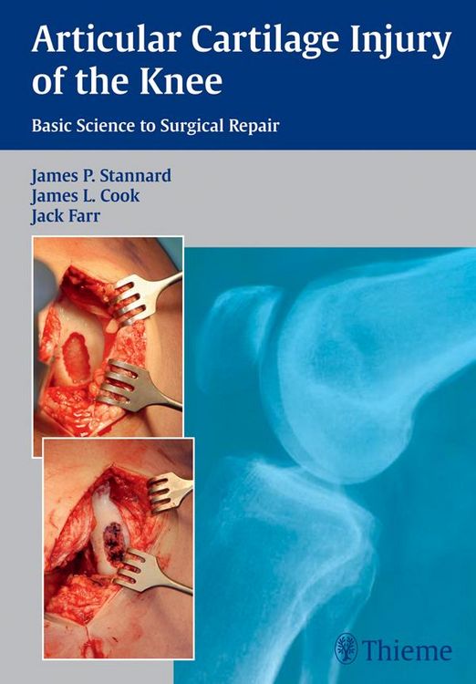 Produktbild: Articular Cartilage Injury of the Knee: Basic Science to Surgical Repair