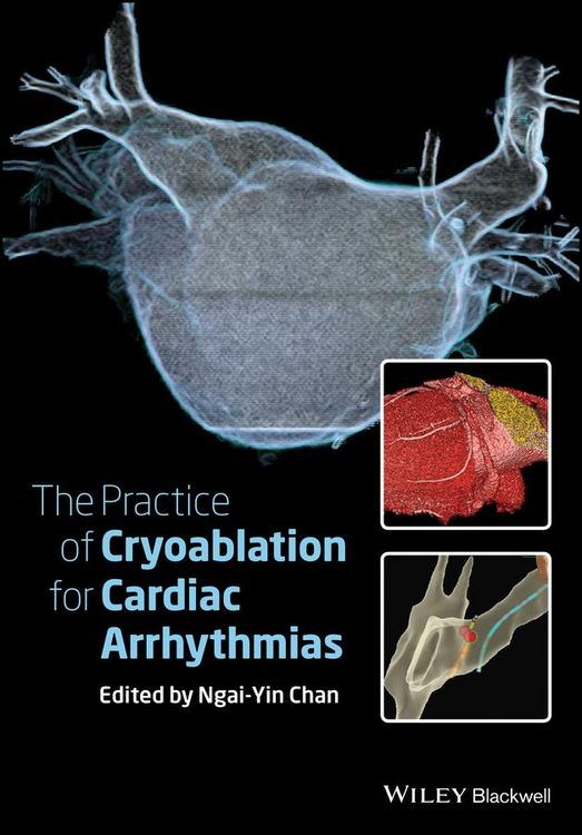 Produktbild: The Practice of Catheter Cryoablation for Cardiac Arrhythmias