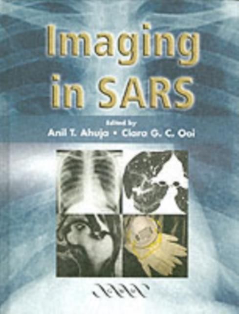 Produktbild: Imaging in SARS