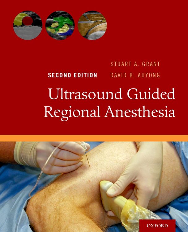 Produktbild: Ultrasound Guided Regional Anesthesia
