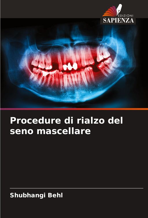 Produktbild: Procedure di rialzo del seno mascellare