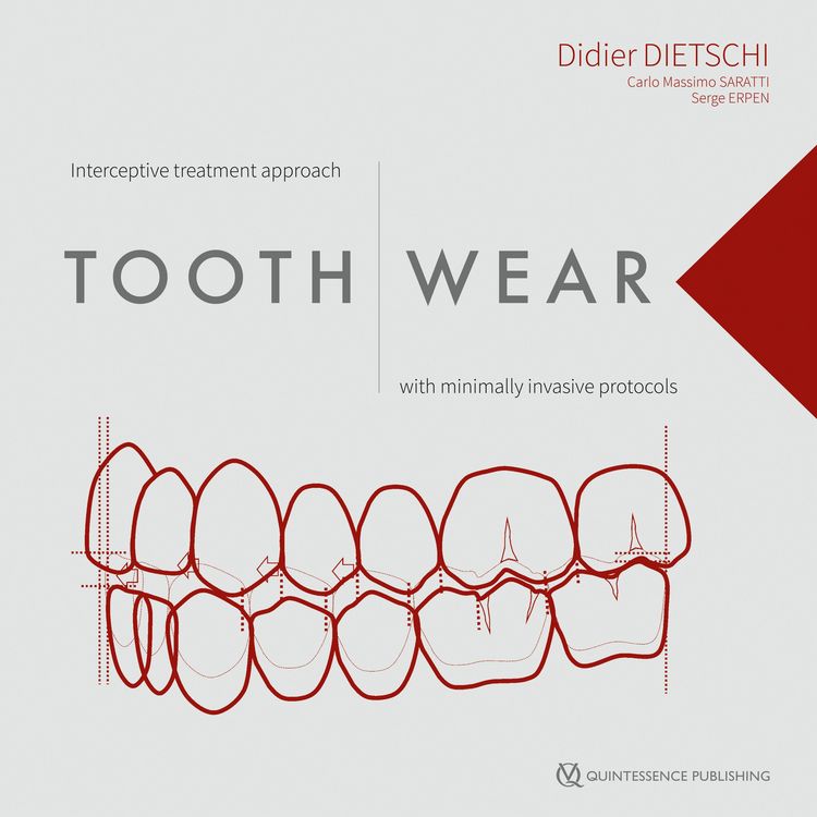 Produktbild: Tooth Wear