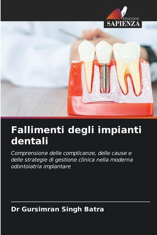 Produktbild: Fallimenti degli impianti dentali