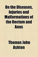 Produktbild: On the Diseases, Injuries and Malformations of the Rectum and Anus