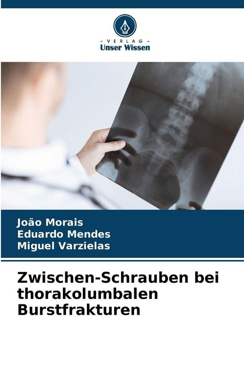 Produktbild: Zwischen-Schrauben bei thorakolumbalen Burstfrakturen