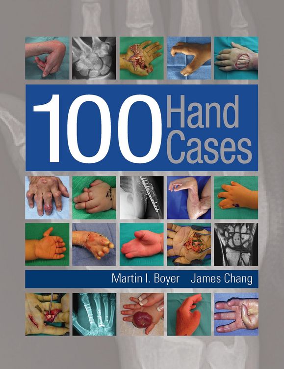 Produktbild: 100 Hand Cases