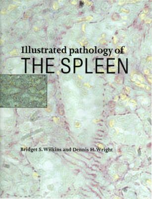 Produktbild: Illustrated Pathology of the Spleen