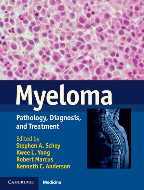 Produktbild: Myeloma