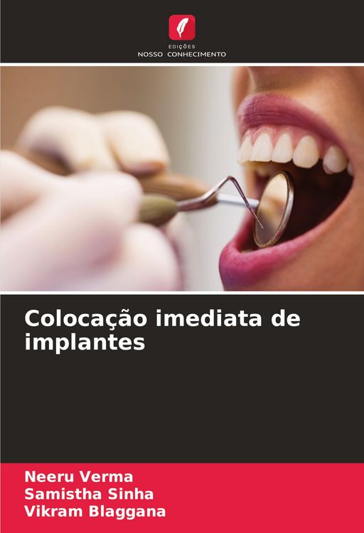 Produktbild: Coloca&ccedil;&atilde;o imediata de implantes