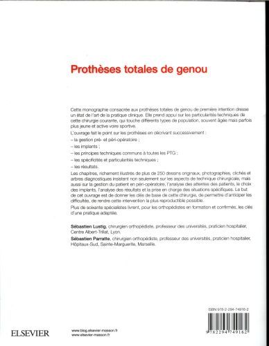 Produktbild: Proth&egrave;ses totales du genou