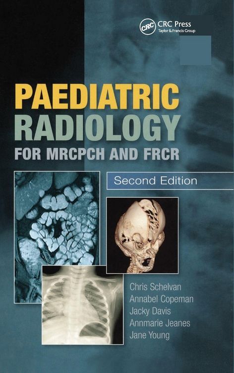 Produktbild: Paediatric Radiology for MRCPCH and FRCR, Second Edition