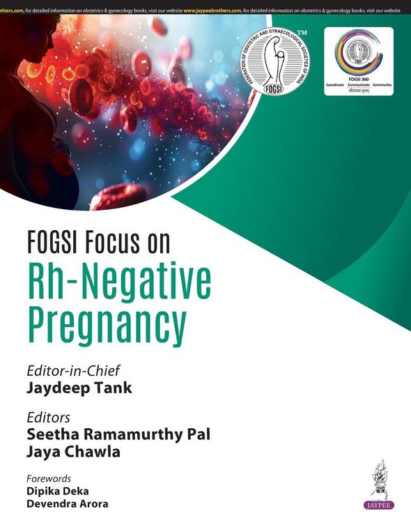 Produktbild: FOGSI Focus on Rh-Negative Pregnancy