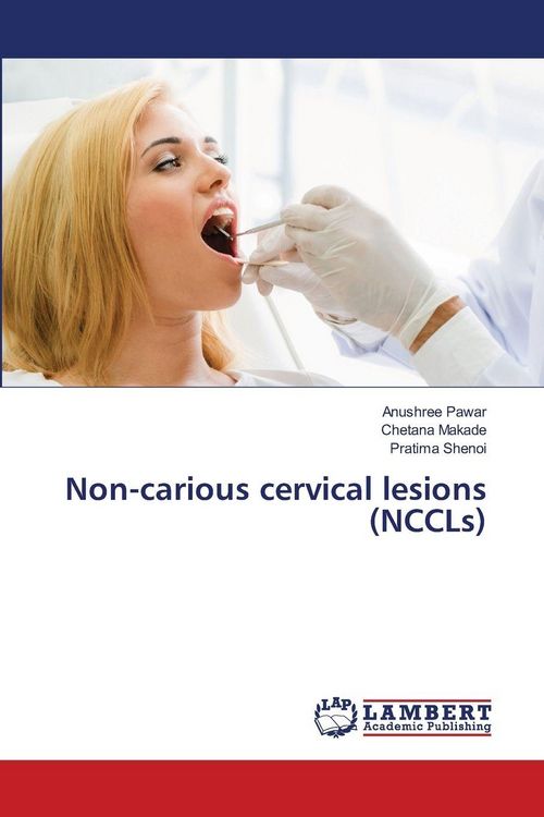 Produktbild: Non-carious cervical lesions (NCCLs)