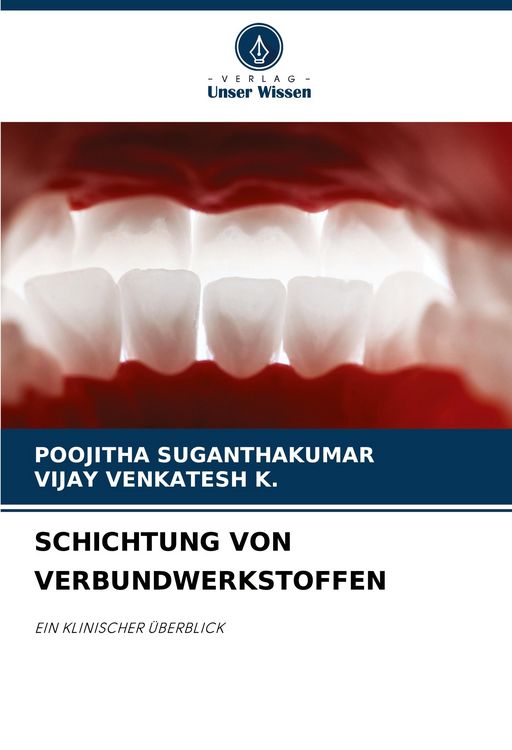 Produktbild: Schichtung von Verbundwerkstoffen