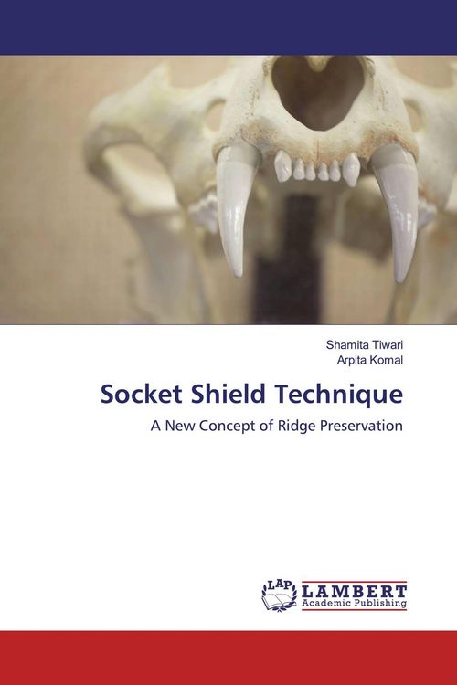 Produktbild: Socket Shield Technique