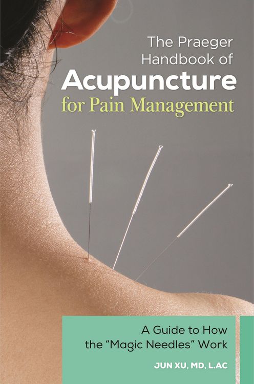 Produktbild: The Praeger Handbook of Acupuncture for Pain Management