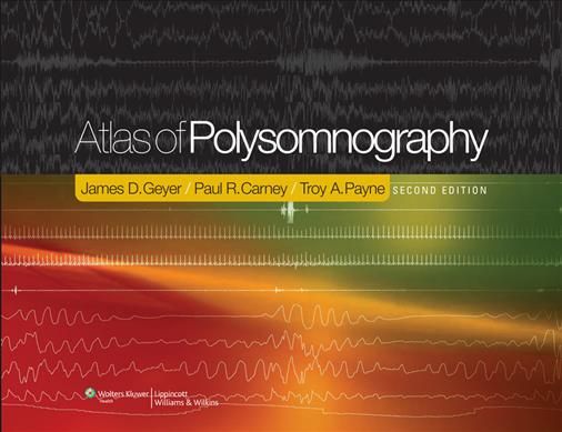 Produktbild: Atlas Of Polysomnography 2/e