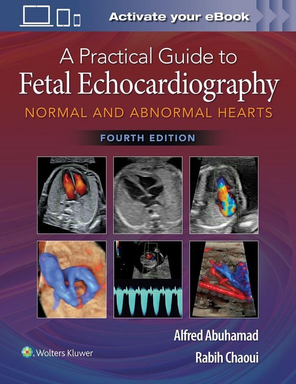 Produktbild: A Practical Guide to Fetal Echocardiography