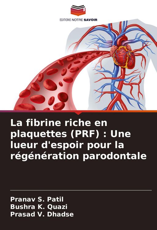 Produktbild: La fibrine riche en plaquettes (PRF) : Une lueur d'espoir pour la r&eacute;g&eacute;n&eacute;ration parodontale