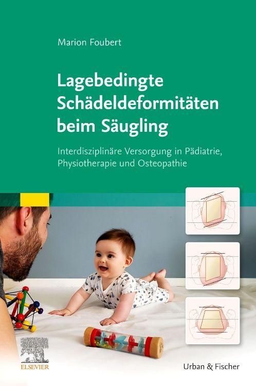 Produktbild: Lagebedingte Sch&auml;deldeformit&auml;ten beim S&auml;ugling