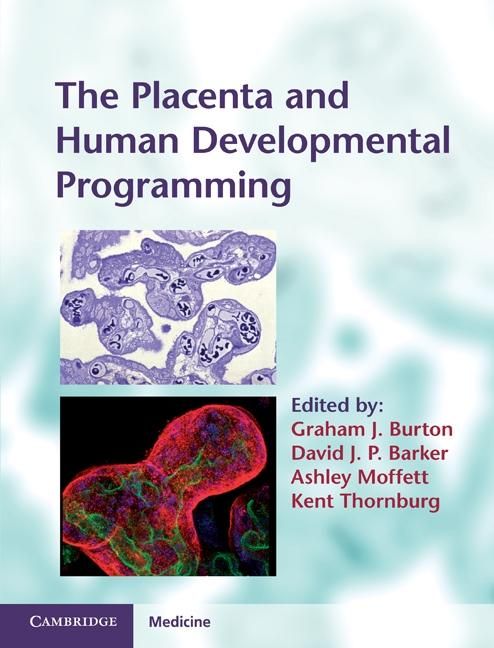 Produktbild: Placenta and Human Developmental Programming